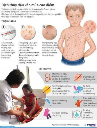 BÀI TUYÊN TRUYỀN PHÒNG CHỐNG BỆNH THỦY ĐẬU