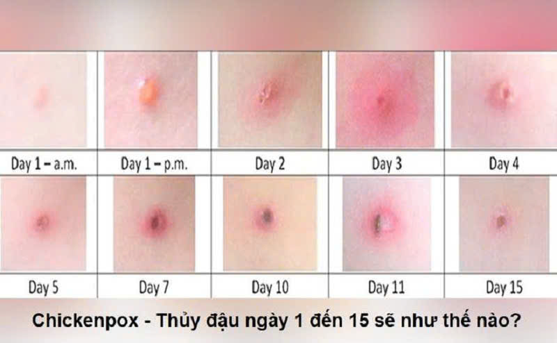 z7564730475733 70b8749c5b9154be2f5b11dcdc3de145